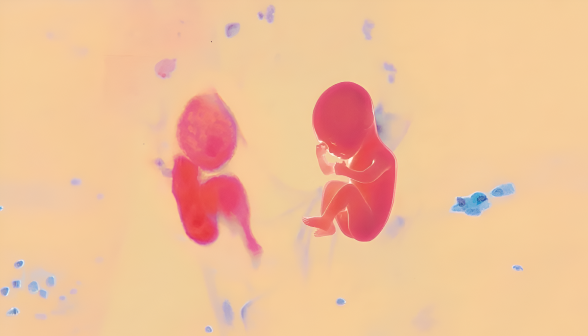 Arriva PAP-ART: il primo evento artistico sulla prevenzione del Papilloma Virus 2 Arriva PAP-ART: il primo evento artistico sulla prevenzione del Papilloma Virus 1