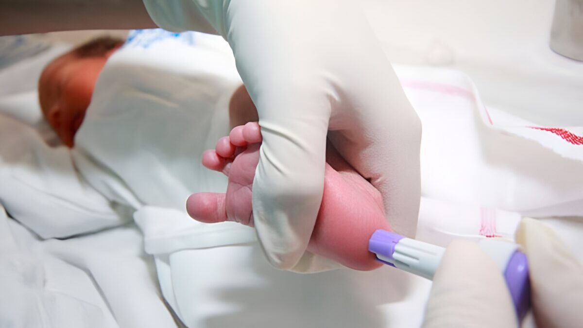 Puglia, screening neonatale salva neonato da una malattia rarissima: solo 4 casi al mondo 1